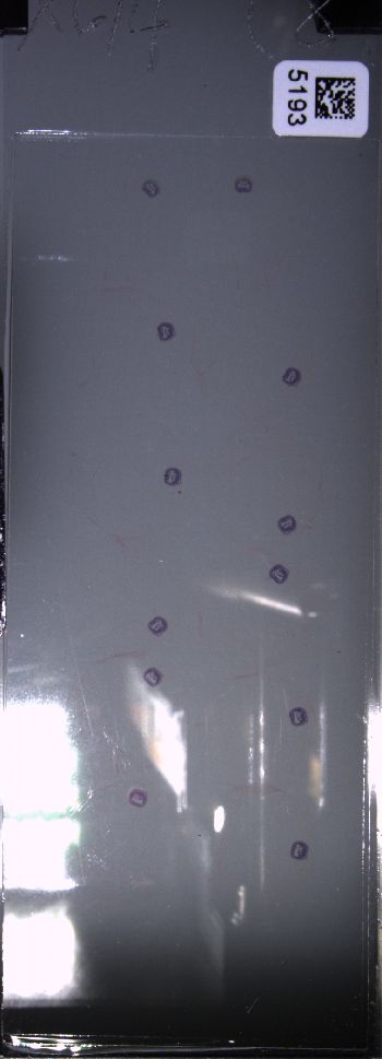 Media type: image; Special Collections 4011   shows specimen_part histological serial section;